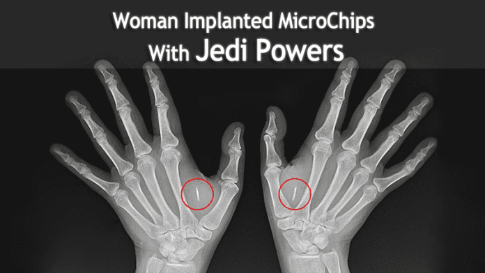 This Woman Implanted MicroChips With Jedi Powers In Her Hand - 92